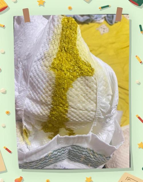 新生儿大便全是奶瓣是消化不良还是正常现象？-第2张图片-郑州医学网