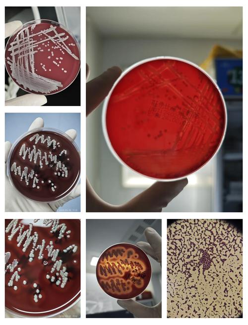 新生儿人葡萄球菌亚种-第2张图片-郑州医学网