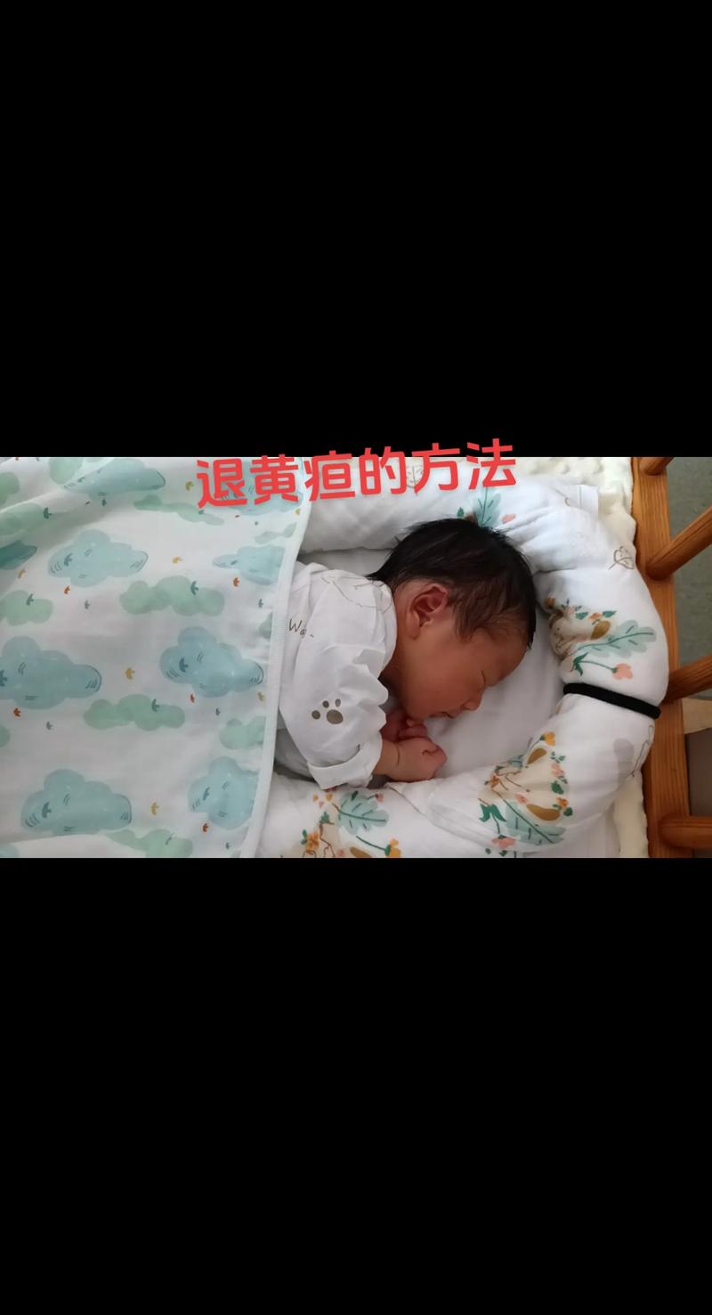 新生儿黄疸到底能不能自行消退？家长需要观察哪些信号？-第2张图片-郑州医学网