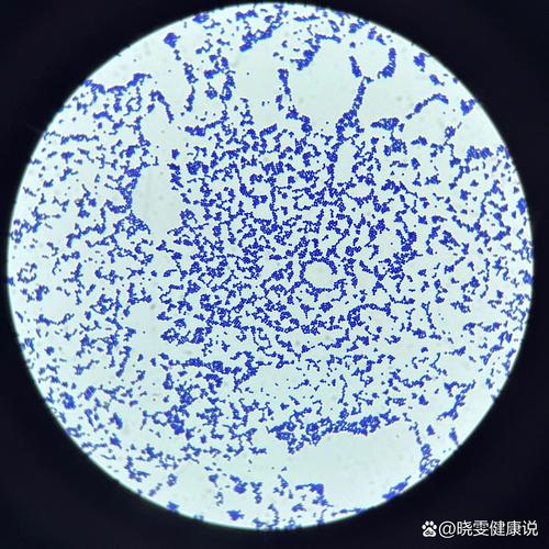 新生儿人亚种葡萄球菌-第3张图片-郑州医学网