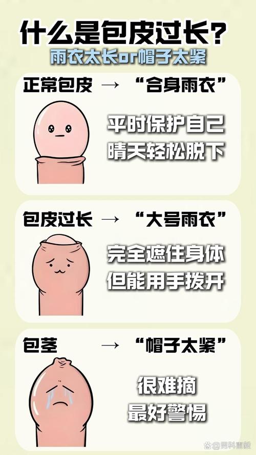 银川治疗儿童包皮过长-第3张图片-郑州医学网