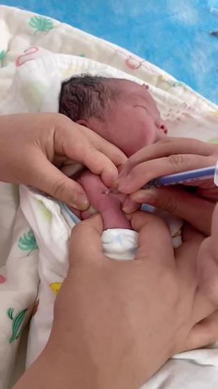 新生儿打了乙肝疫苗后-第2张图片-郑州医学网