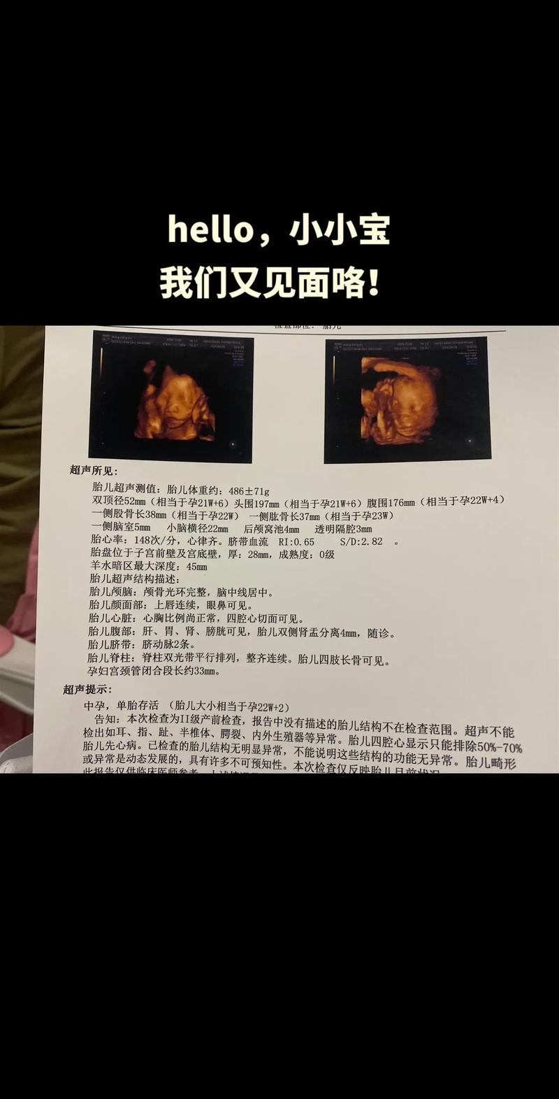 孕期大排畸都检查什么-第3张图片-郑州医学网