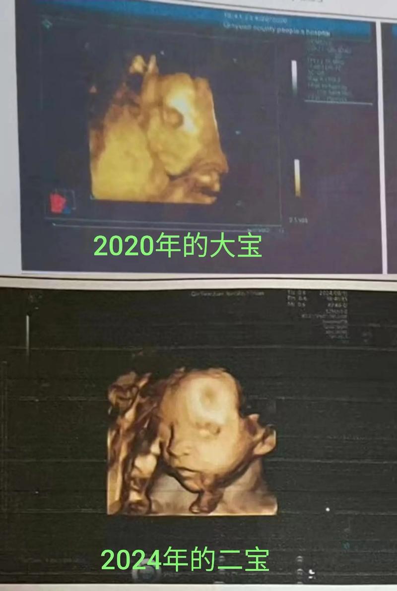 宣城妇女儿童医院四维彩超能看清宝宝哪些细节？检查流程和预约方式是怎样的？-第3张图片-郑州医学网