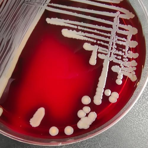 新生儿金色葡萄菌感染-第3张图片-郑州医学网