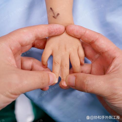 白白手拉手儿童治疗版-第2张图片-郑州医学网