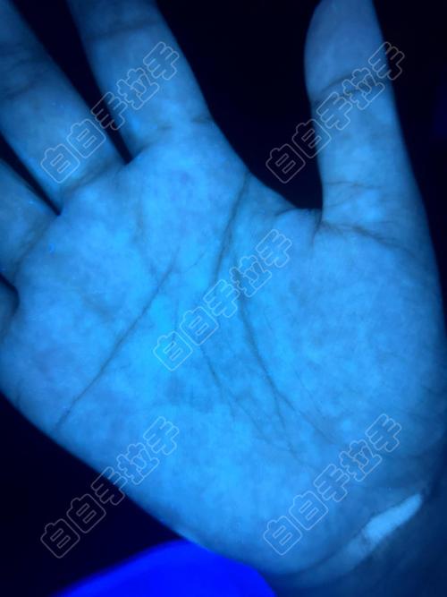 白白手拉手儿童治疗版-第1张图片-郑州医学网