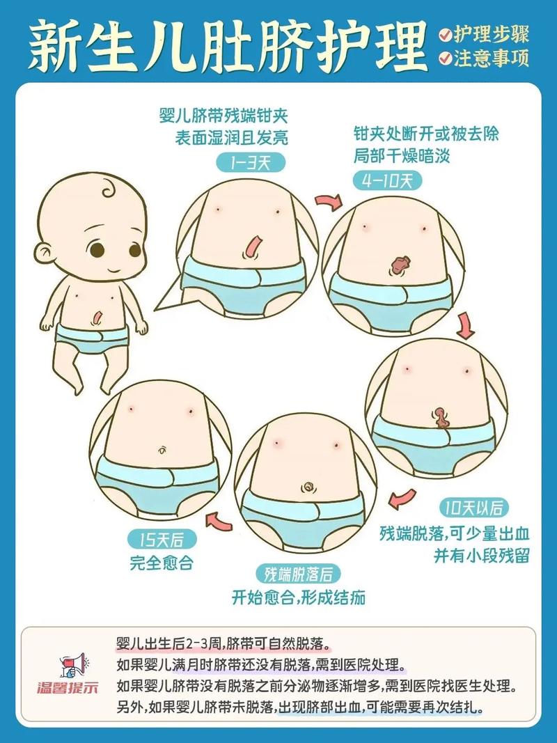 新生儿脐带护理不当会感染吗？日常清洁与干燥要注意哪些细节？-第1张图片-郑州医学网