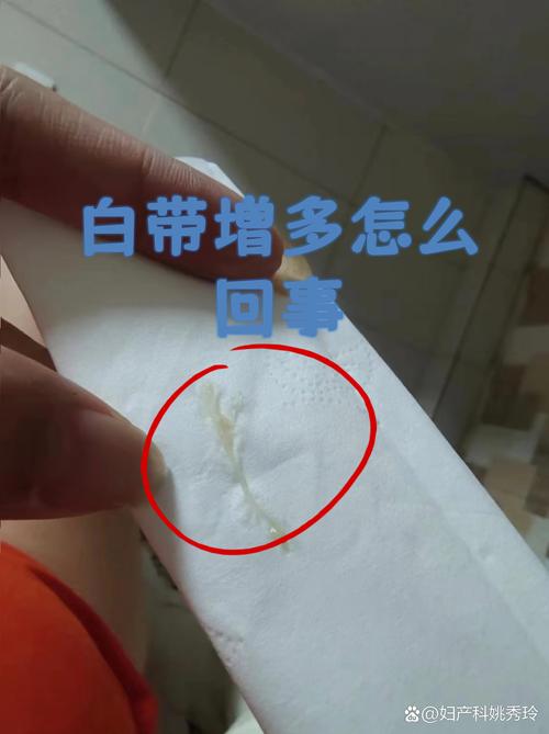 孕期什么时候检查白带-第2张图片-郑州医学网