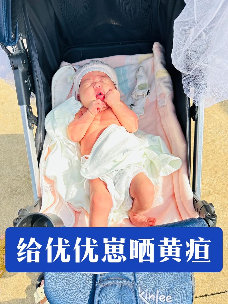 新生儿19天黄疸11-第2张图片-郑州医学网