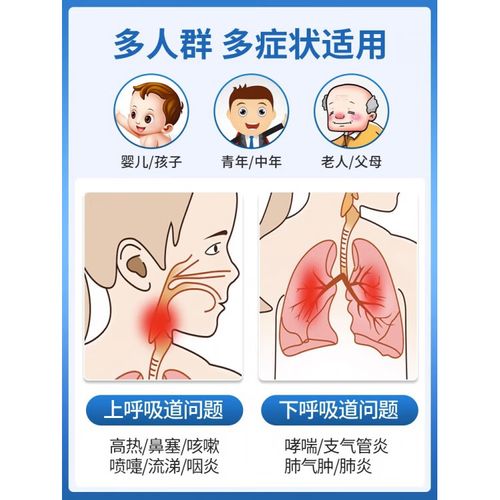 儿童雾化机价格差异大，不同品牌功能款式多少钱一台？-第2张图片-郑州医学网