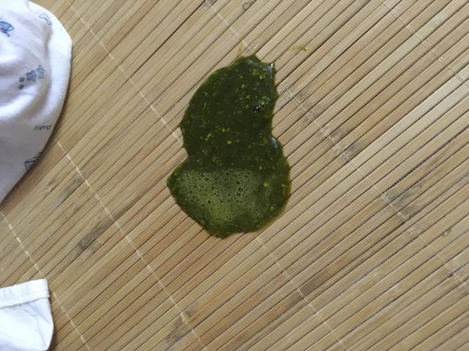 新生儿拉绿色大便 稀-第1张图片-郑州医学网