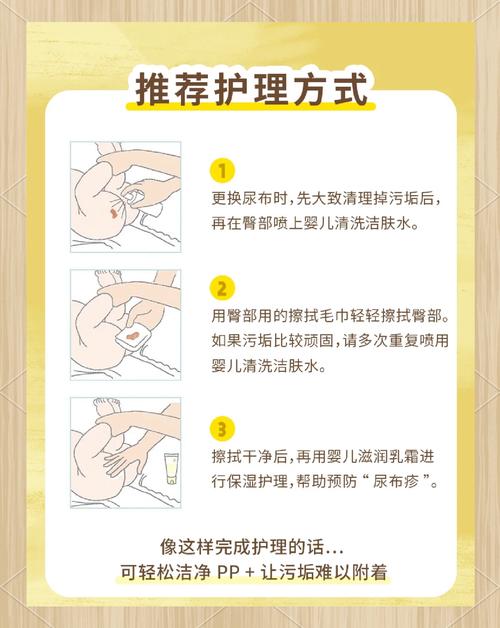 如何给新生儿换纸尿片-第1张图片-郑州医学网