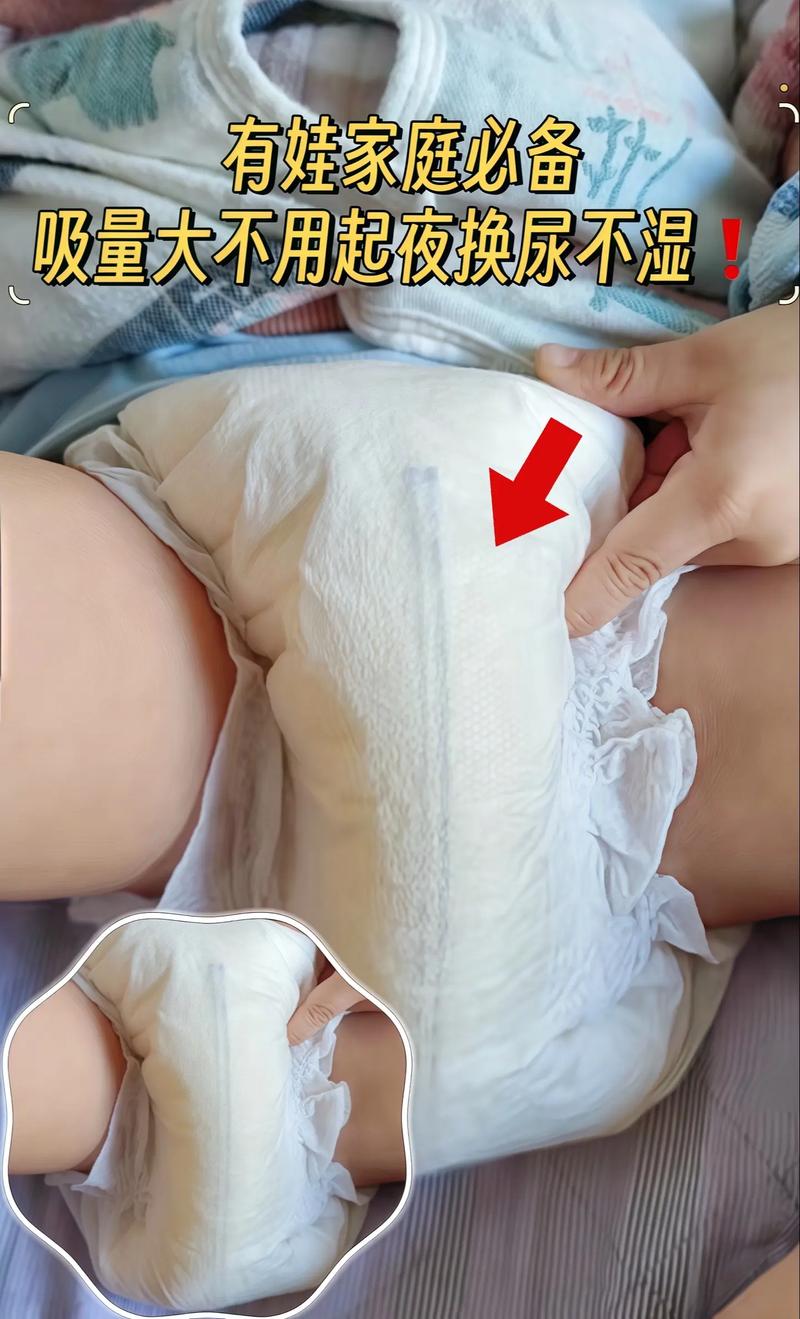 如何给新生儿换纸尿片-第3张图片-郑州医学网