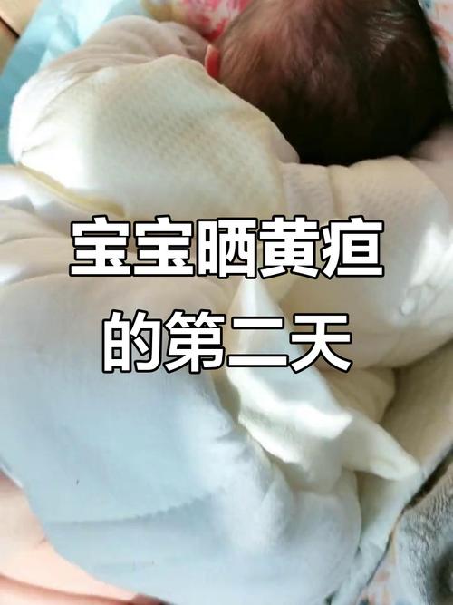 新生儿黄疸偏高的症状-第2张图片-郑州医学网