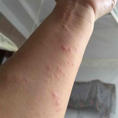 孕期病毒感染什么症状-第1张图片-郑州医学网