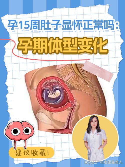 孕期15周要注意哪些饮食、运动及产检事项？-第2张图片-郑州医学网