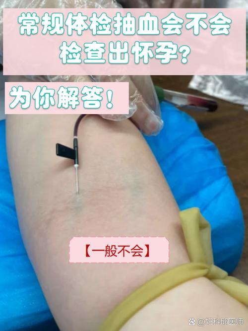 孕期抽血前到底能不能喝水？喝多少会影响化验结果吗？-第3张图片-郑州医学网