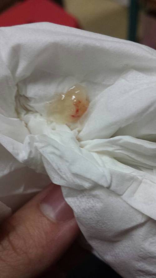 孕期花粉过敏对胎儿健康会有哪些潜在影响？-第3张图片-郑州医学网