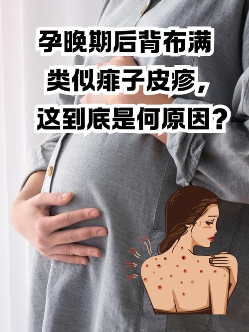 孕期花粉过敏对胎儿健康会有哪些潜在影响？-第2张图片-郑州医学网