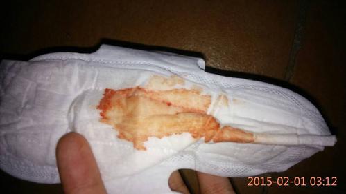 孕期大便时白带有血丝-第1张图片-郑州医学网