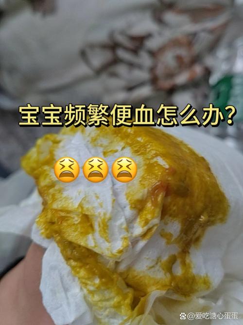 新生儿 大便少量血丝-第3张图片-郑州医学网