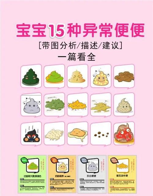 新生儿屎拉不出怎么办-第2张图片-郑州医学网