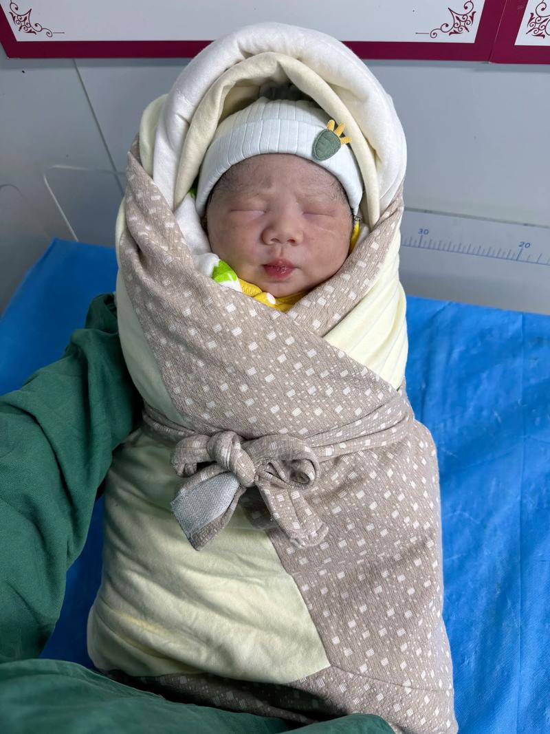 21三体综合症新生儿-第1张图片-郑州医学网