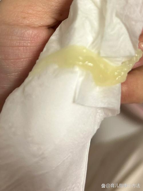 孕期白带发黄有点酸味-第1张图片-郑州医学网
