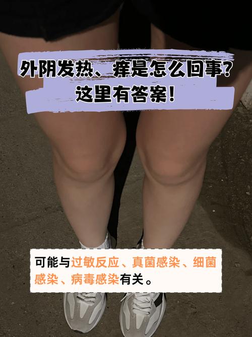 孕期阴部摩擦红肿疼痛怎么办？如何缓解不适又不影响胎儿健康？-第2张图片-郑州医学网