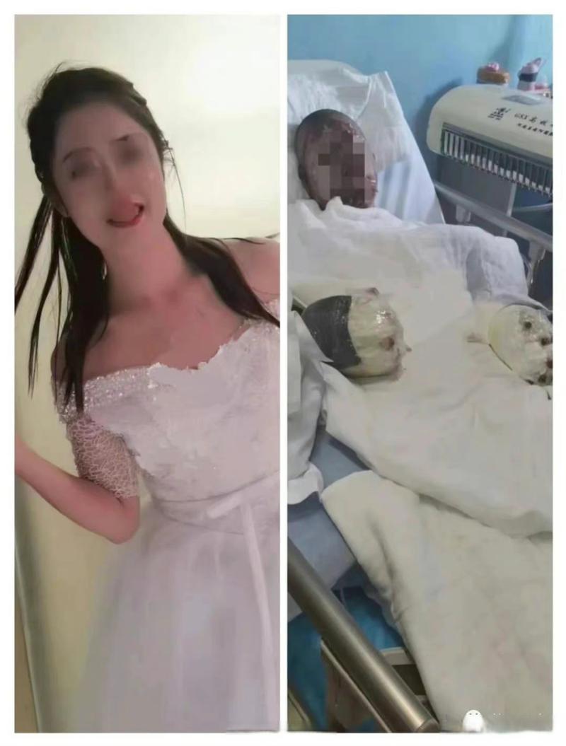 怀化红雅妇女儿童致死-第2张图片-郑州医学网