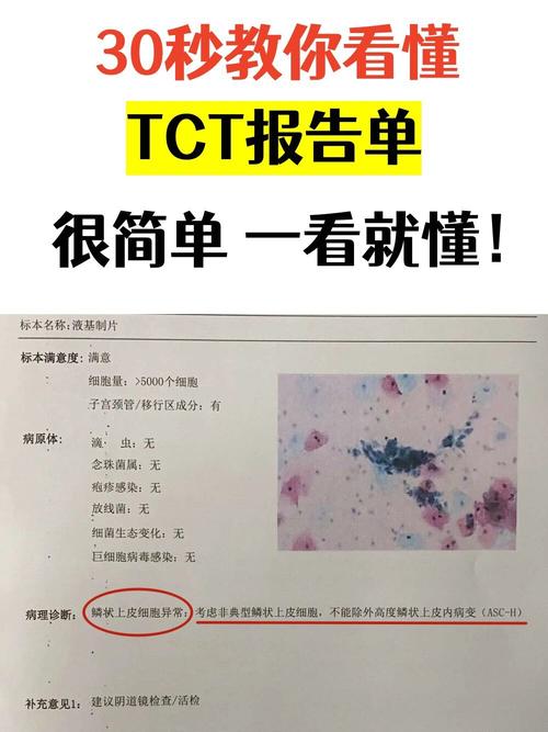 孕期能做tct检查吗-第2张图片-郑州医学网