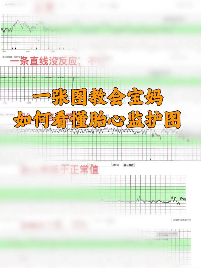 孕期怎样检查是否缺氧-第1张图片-郑州医学网