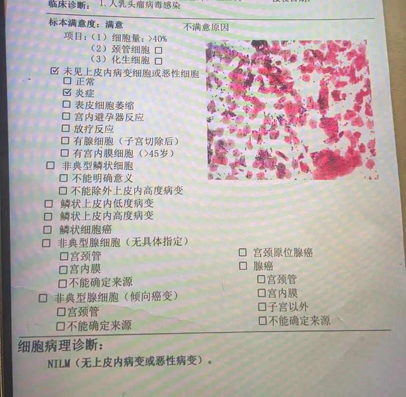 孕期tct检查是什么-第1张图片-郑州医学网