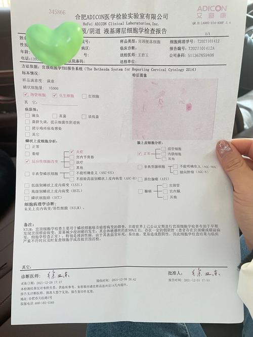 孕期tct检查是什么-第2张图片-郑州医学网