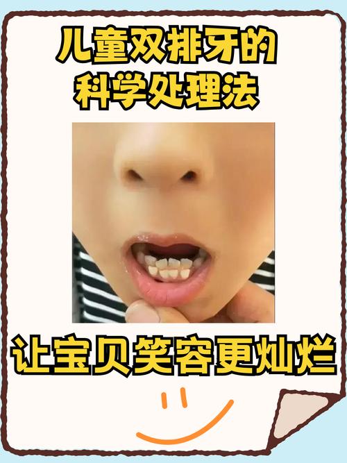 6岁儿童长双排牙是正常现象吗？需要拔牙干预吗？如何正确处理？-第1张图片-郑州医学网