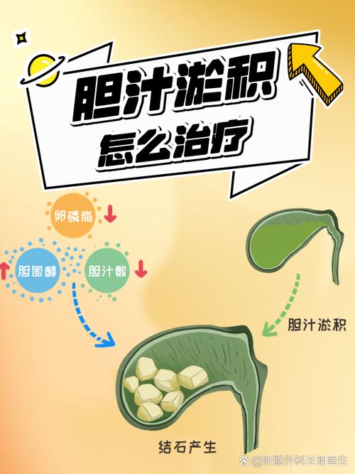 孕期如何预防胆汁淤积-第3张图片-郑州医学网