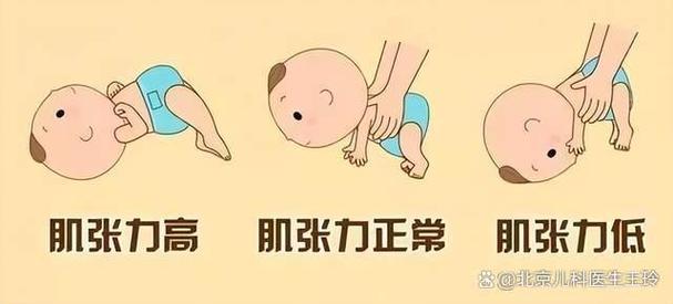 引起新生儿脑瘫的原因-第3张图片-郑州医学网