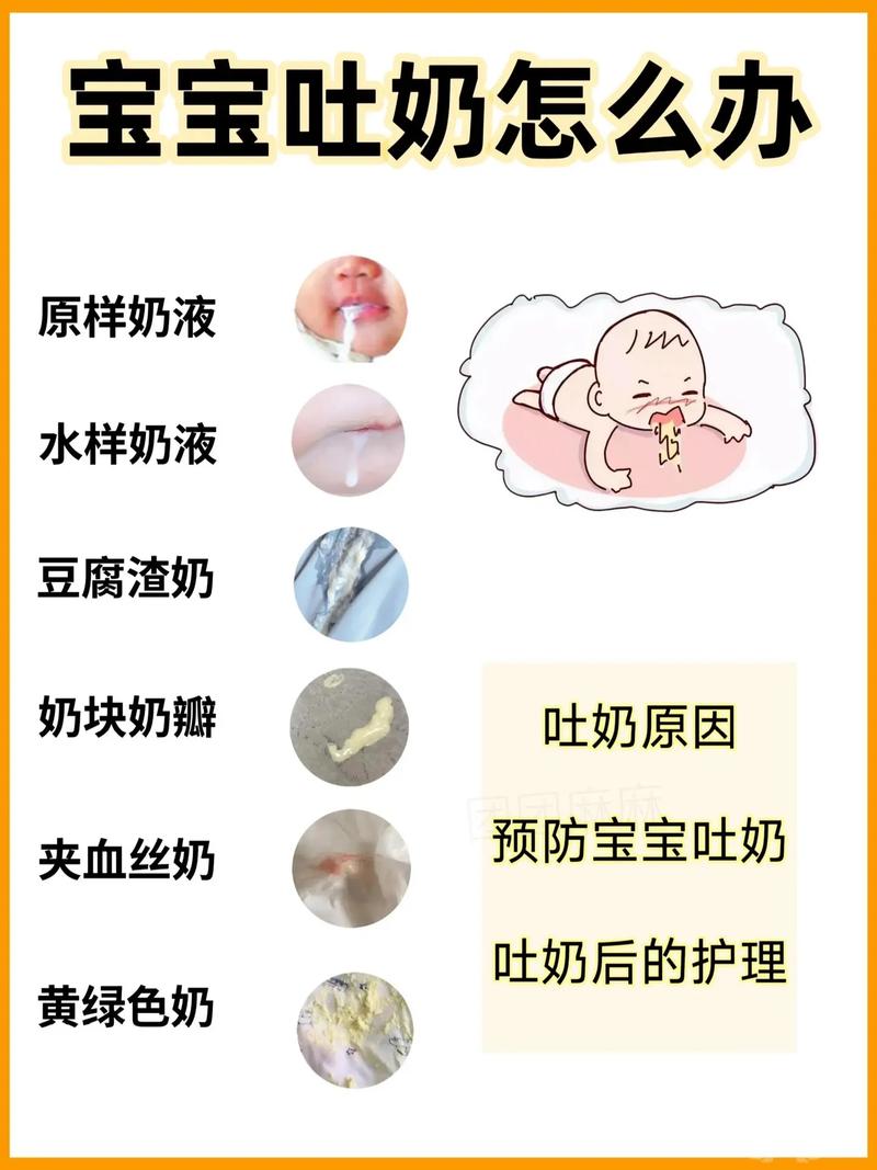新生儿 换奶粉 吐奶-第1张图片-郑州医学网