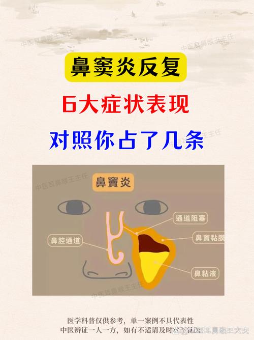 儿童鼻窦炎有哪些典型症状？如何科学治疗才能避免复发？-第1张图片-郑州医学网