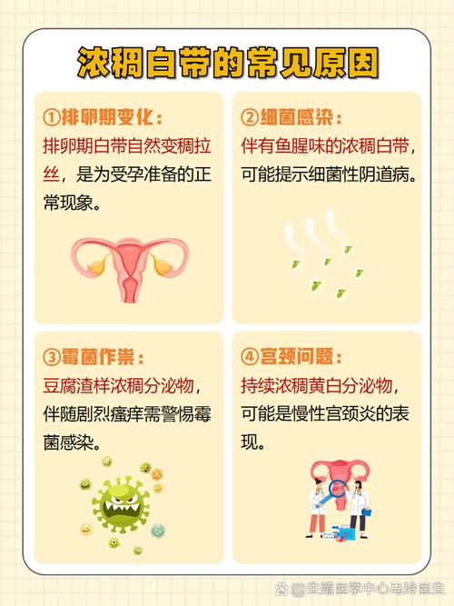 孕期白带检查出霉菌，对胎儿有影响吗？需要怎么治疗才安全？-第2张图片-郑州医学网