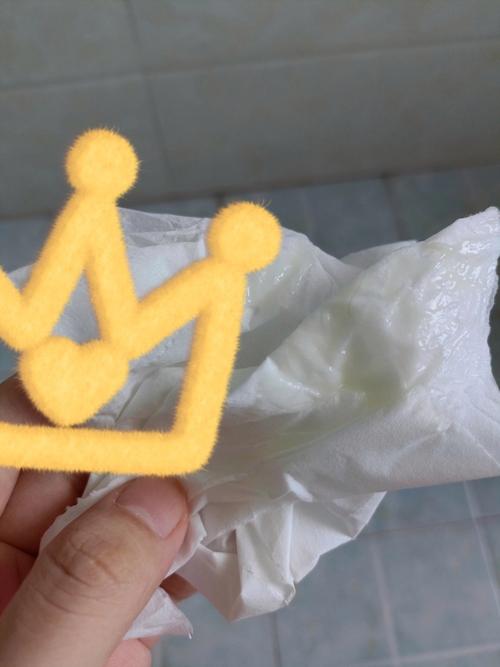 孕期白带检查出霉菌,对胎儿有影响吗?需要怎么治疗才安全?-第1张图片-郑州医学网 孕期白带检查出霉菌,对胎儿有影响吗?需要怎么治疗才安全?-第1张图片-郑州医学网