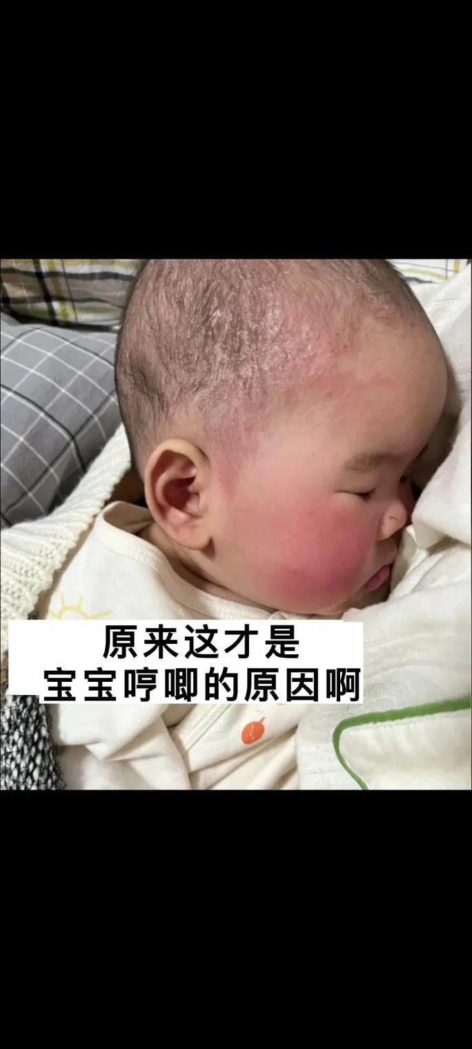 新生儿不睡觉哼哼唧唧-第3张图片-郑州医学网