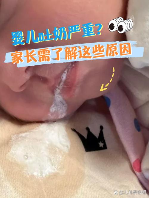 新生儿总吐怎么回事啊-第3张图片-郑州医学网