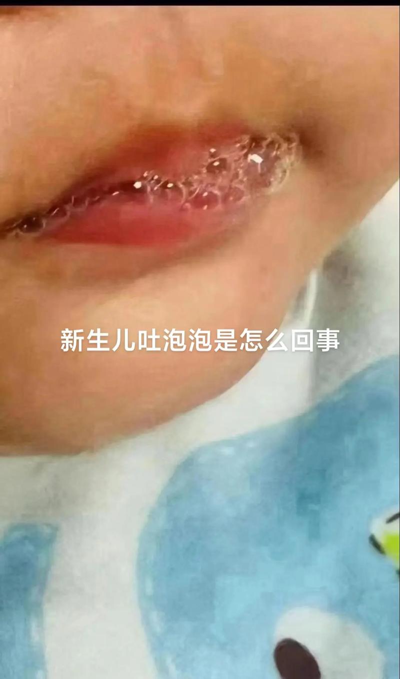 新生儿吐泡泡、咳嗽又吐奶，是正常生理现象还是疾病信号？-第2张图片-郑州医学网