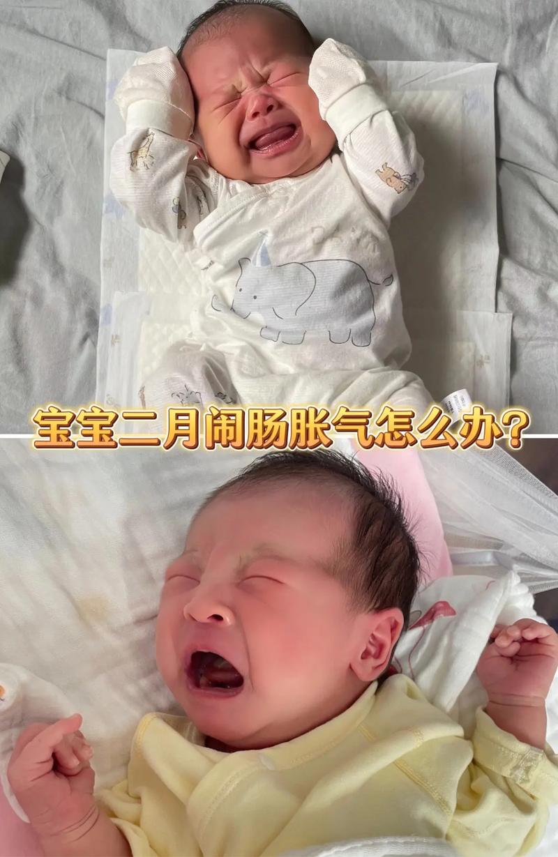 新生儿肠梗阻有哪些典型症状？家长该如何早期识别与应对？-第3张图片-郑州医学网