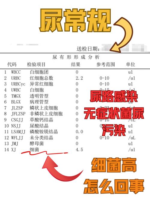 孕期尿液检查细菌超标-第2张图片-郑州医学网