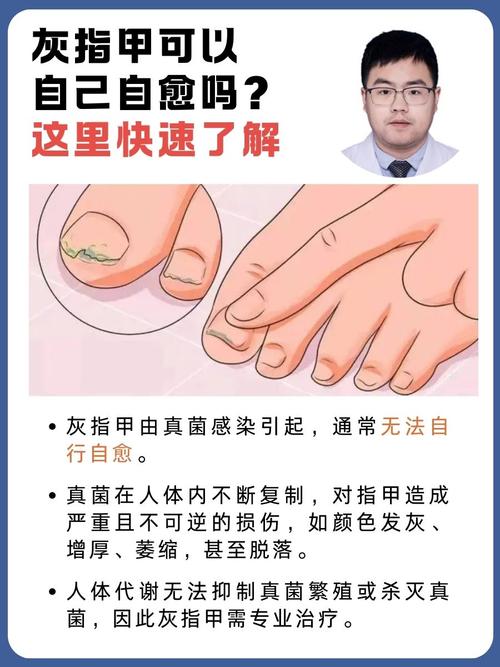 怀孕期间灰指甲怎么办-第1张图片-郑州医学网 怀孕期间灰指甲怎么办-第1张图片-郑州医学网