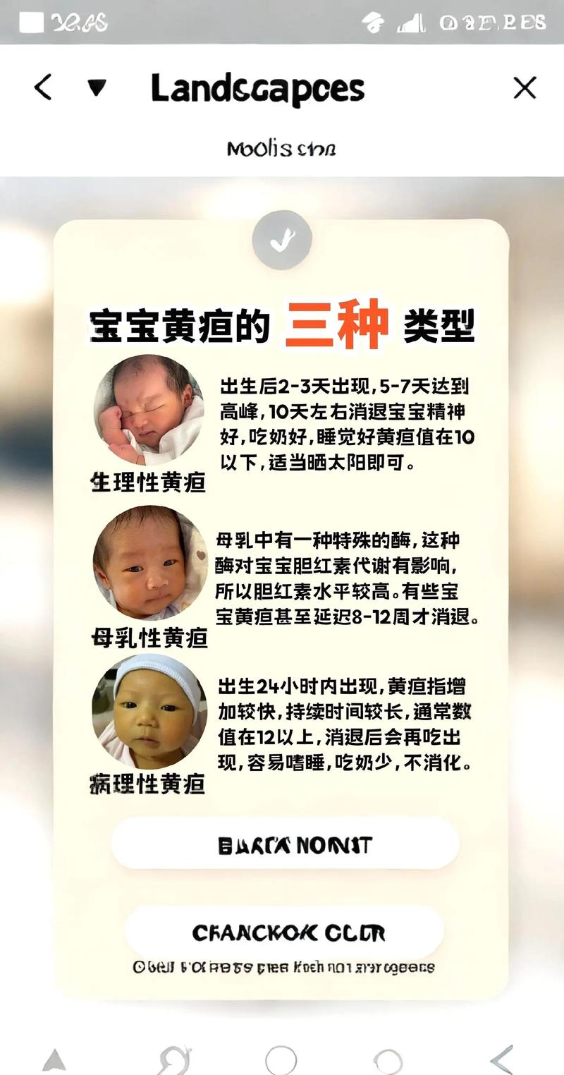 新生儿黄疸症状有哪些表现?家长该如何辨别与应对?-第1张图片-郑州医学网 新生儿黄疸症状有哪些表现?家长该如何辨别与应对?-第1张图片-郑州医学网