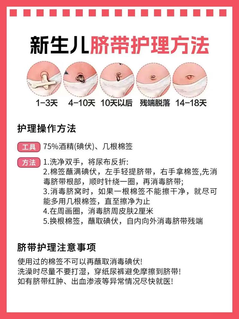 怎么给新生儿肚脐消毒-第2张图片-郑州医学网